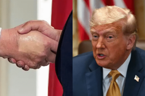 Trump volta a aparecer em público usando maquiagem na mão, um mês depois de diagnóstico de insuficiência venosa crônica