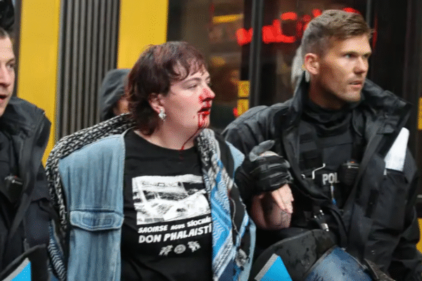 Irlanda condena violência policial contra ativista em Berlim
