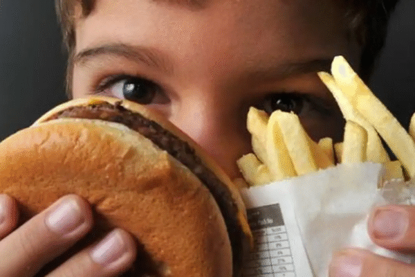 Unicef: obesidade infantil supera desnutrição pela 1ª vez no mundo