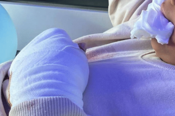 Estudante brasileiro de 9 anos tem dois dedos decepados em escola de Portugal: caso abre investigação